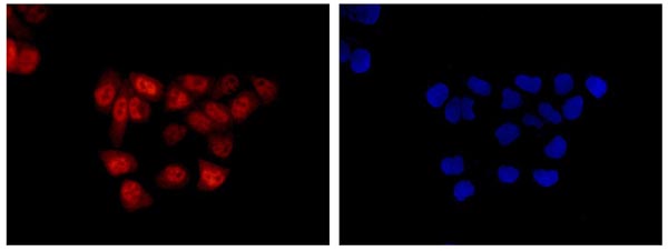 Immunofluorescent analysis of acetone-fixed HeLa cells labeling S100 alpha 6 with ab181975 at 1/500 dilution, followed by Goat anti rabbit IgG (Dylight 555) at 1/200 dilution (red). Dapi staining (blue).