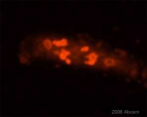 ab 13541 at a 1/2000 dilution staining U2OS cells by Immunocytochemistry. The antibody was incubated with the cells for 1 hour and then detected using a Alexa-Fluor ® 594 chicken anti-mouse antibody. This image is courtesy of an Abreview submitted by Raffaela Santoro on 16 March 2006.See Abreview