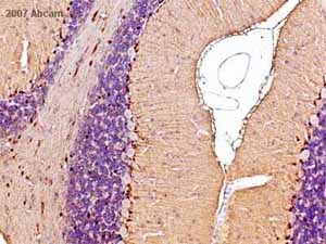 ab14849 at 1/3000 staining rat brain tissue sections by IHC-P. The tissue was formaldehyde fixed and a heat mediated antigen retrieval step was performed before incubation with the antibody. A biotinylated goat anti-mouse IgG was used as the secondary.See Abreview