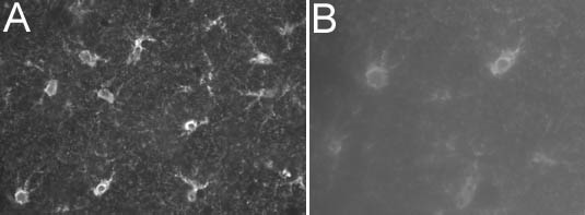 ab8330 at a dilution of 1/1000, staining S100 (Alexa 488 secondary at 1/2000) on rat brain tissue (30µm thick coronal sections) in free floating IHC (see protocol link for detailed description). Images showing neuron body and processes: [A] 20x objective and [B] 40x objective.NB: No labeling observed following omission of primary antibody.Sections were viewed using an Axioplan 2 Imaging microscope (Imaging Associates) fitted with 10x, 20x and 40x Plan-Neofluorobjectives (Zeiss, Germany) and images were taken using a AxioCam Hrm digital camera (Zeiss, Germany) and AxioVision software (Imaging Associates).