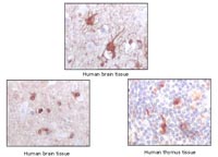 Immunohistochemical analysis of paraffin-embedded human brain and thymus tissue, showing nuclear and cyroplasmatic location using S100 beta antibody (ab109655) with DAB staining.