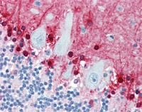 Human Brain, Cerebellum (formalin-fixed, parafilm embedded) stainned with S100 beta antibody (ab109655) followed by biotinylated anti-mouse IgG secondary antibody, alkaline phosphatase-streptavidin and chromogen.