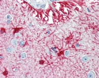 Human Brain, Cortex (formalin-fixed, parafilm embedded) stainned with S100 beta antibody (ab109655) followed by biotinylated anti-mouse IgG secondary antibody, alkaline phosphatase-streptavidin and chromogen.