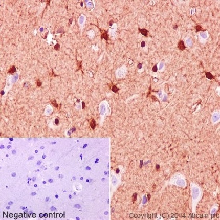Immunohistochemical analysis of paraffin embedded Human cerebral cortex tissue labeling S100 beta with purified ab52642 at 1/1000 dilution. Secondary antibody was Goat Anti-Rabbit IgG H&L (HRP) (ab97051) at 1/500 dilution. Counter stain: Hematoxylin.Negative control: Using PBS instead of primary antibody.