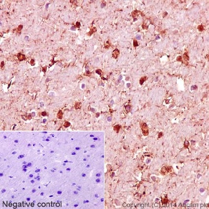 Immunohistochemical analysis of paraffin embedded Rat cerebral cortex tissue labeling S100 beta with purified ab52642 at 1/1000 dilution. Secondary antibody was Goat Anti-Rabbit IgG H&L (HRP) (ab97051) at 1/500 dilution. Counter stain: Hematoxylin.Negative control: Using PBS instead of primary antibody.