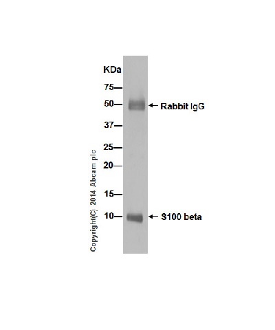 S100 beta was immunoprecipitated from Human fetal brain with purified ab52642 at 1/50 dilution. Western blot was performed from the immunoprecipitate using ab52642 and Goat Anti-Rabbit IgG, (H+L), Peroxidase conjugated was used as secondary antibody at 1/1000 dilution.Blocking and dilution buffer and concentration: 5% NFDM/TBST.