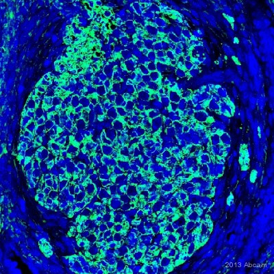Unpurified ab52642 staining S100 beta in Human spiral ganglion tissue sections by Immunohistochemistry (IHC-P - paraformaldehyde-fixed, paraffin-embedded sections). Tissue was fixed with paraformaldehyde and blocked with 1% BSA for 30 minutes at room temperature; antigen retrieval was by heat mediation in citrate buffer, pH6.0. Samples were incubated with primary antibody (1/200 in PBS-T + 1% BSA) for 12 hours. An Alexa Fluor® 488-conjugated Donkey anti-rabbit IgG polyclonal (1/500) was used as the secondary antibody.See Abreview