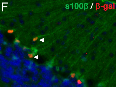 Immunohistochemical analysis of embryonic mouse brain tissue, staining S100 beta with unpurified ab52642.