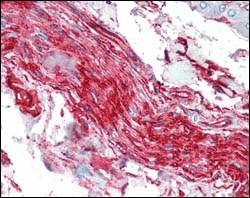ab52272 at 1/1000 dilution staining S100A10 in human brain tissue section by Immunohistochemistry (Formalin/ PFA fixed paraffin-embedded sections). The image show positive staining in nerve and ganglion cells with ab52272.