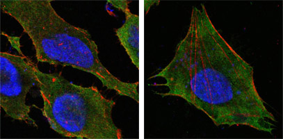 ab52272 at 1/500 dilution staining S100A10 in human Hela (left) and L-02 (right) cells by immunocytochemistry/ Immunofluorescence. An Alexa Fluor® 488 conjugated Goat polyclonal to mouse IgG was used as secondary antibody. Image show green staining with primary antiobody whilst actin filaments were stained red with DY-554 Phalloidin. Nuclei were stained blue using DRAQ5 fluorescent DNA dye.