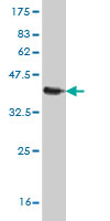 Western blot against tagged recombinant protein immunogen using ab55699 S100A11 antibody at 1ug/ml.