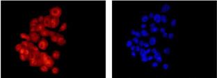 Immunofluorescence analysis of BxPC-3 cells (fixative 4% paraformaldehyde) labeling S100A11 with ab180593 at a 1/100 dilution (left image), and counterstained with Dapi (right image). Goat anti rabbit IgG (Dylight 555) secondary used at a 1/200 diution.