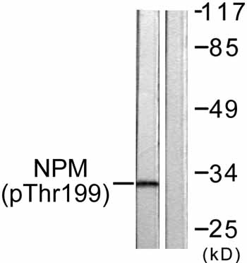 All lanes : Anti-Nucleophosmin (phospho T199) antibody (ab59353) at 1/500 dilutionLane 1 : Extracts from Jurkat cells with no immunizing peptideLane 2 : Extracts from Jurkat cells with immunizing peptideObserved band size : 33 kDa (why is the actual band size different from the predicted?)