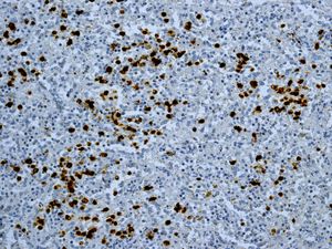 Unpurified ab124743, at 1/500 dilution, staining S100P in paraffin-embedded human spleen tissue by immunohistochemistry.