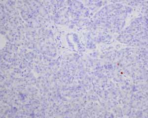 Unpurified ab124743 showing negative staining in normal pancreas tissue.