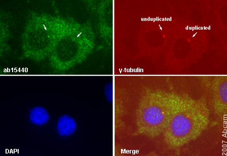 ab15440 detecting Nucleophosmin in interphase mouse primary embryonic fibroblasts. Cells were also counterstained with anti gamma tubulin antibody and DAPI in order to highlight the centrossomes and the nucleus (respectively). Secondary antibodies: goat anti-rabbit IgG conjugated to Alexa 488 (for ab15440) and goat anti-mouse IgG conjugated to Alexa 594 (for gamma-tubulin antibody). 