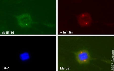 ab15440 detecting Nucleophosmin in mitotic mouse primary embryonic fibroblasts. Cells were also counterstained with anti gamma tubulin antibody and DAPI in order to highlight the centrossomes and the nucleus (respectively). Secondary antibodies: goat anti-rabbit IgG conjugated to Alexa 488 (for ab15440) and goat anti-mouse IgG conjugated to Alexa 594 (for gamma-tubulin antibody).