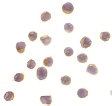 ab36864 at 10µg/ml staining S6K in Jurkat cells by Immunocytochemistry.