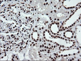Immunohistochemical analysis of paraffin-embedded Human kidney tissue labelling SAE1 with ab140964 at 1/150 dilution.