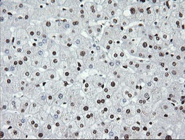 Immunohistochemical analysis of paraffin-embedded Human liver tissue labelling SAE1 with ab140964 at 1/150 dilution.