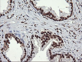 Immunohistochemical analysis of paraffin-embedded Human prostate tissue labelling SAE1 with ab140964 at 1/150 dilution.