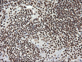 Immunohistochemical analysis of paraffin-embedded Human lymmphoma tissue labelling SAE1 with ab140964 at 1/150 dilution.