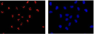 Immunofluorescent analysis of -20℃ acetone-fixed HeLa cells labeling SAE1 with ab185949 at 1/100 dilution. Secondary ab: Goat anti rabbit IgG (Alexa Fluor®555) at 1/200 dilution. Counter stain: Dapi (blue).