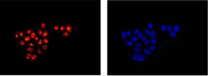 Immunofluorescent analysis of 4% paraformaldehyde-fixed MCF7 cells labeling SAE1 with ab185949 at 1/100 dilution. Secondary ab: Goat anti rabbit IgG (Alexa Fluor®555) at 1/200 dilution. Counter stain: Dapi (blue).