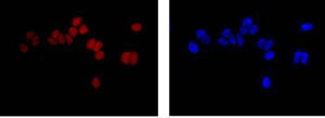 Immunofluorescence analysis of MCF-7 cells labeling SAE1 with ab185552 at 1/500 dilution. Secondary ab: Goat anti rabbit IgG (Alexa Fluor® 555) at 1/200 dilution. Fixative: 4% paraformaldehyde. Counter stain: Dapi.