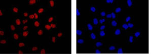 Immunofluorescence analysis of HeLa cells labeling SAE1 with ab185552 at 1/500 dilution. Secondary ab: Goat anti rabbit IgG (Alexa Fluor® 555) at 1/200 dilution. Fixative: 4% paraformaldehyde. Counter stain: Dapi.