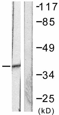 All lanes : Anti-SAE1 antibody (ab58383) at 1/500 dilutionLane 1 : 293 cell extractLane 2 : 293 cell extract with immunising peptide