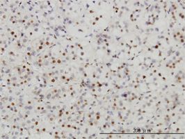 SAE1 antibody (ab56957) used in immunohistochemistry at 3ug/ml on formalin fixed and paraffin embedded human adrenal gland.