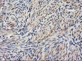 ab118404 at 1/150 dilution staining SAE2 / UBA2 in Paraffin-embedded Human endometrium tissue by Immunohistochemistry.