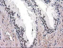 ab118404 at 1/150 dilution staining SAE2 / UBA2 in Paraffin-embedded Human Prostate tissue by Immunohistochemistry.