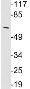 Anti-Nicotinic Acetylcholine Receptor alpha 3 antibody (ab135282) at 1/500 dilution + HeLa cell extract at 30 µg