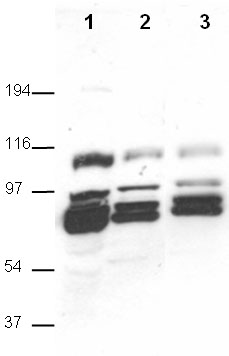 All lanes : Anti-SAP102 antibody (ab12086) at 0.5 µg/mlLane 1 : 10µg mouse whole brain extractLane 2 : 10µg mouse hippocampal extractLane 3 : 10µg mouse hippocampal extract