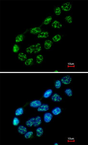 ab96134, at a 1/200 dilution, staining Nucleoporin p62 in paraformaldehyde fixed A431 by Immunofluorescence analysis. Lower image: merged with DNA probe.