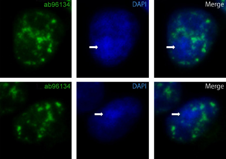Immunofluorescence analysis of A431 cells, staining Nucleoporin p62 with ab96134 at 1/200 dilution, demonstrating punctate nuclear staining.