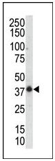 Anti-SAPK3 antibody (ab37932) at 1/100 dilution + mouse muscle tissue lysateSecondaryHRP-anti-rabbit developed using the ECL technique