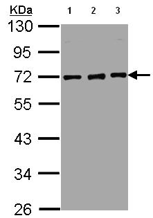 All lanes : Anti-Nucleoporin p62 antibody (ab95956) at 1/5000 dilutionLane 1 : HepG2 whole cell lysateLane 2 : MOLT4 whole cell lysateLane 3 : Raji whole cell lysateLysates/proteins at 30 µg per lane.