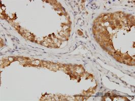 SAPK4 antibody (ab57718) used in immunohistochemistry at 1ug/ml on formalin fixed and paraffin embedded human testis.