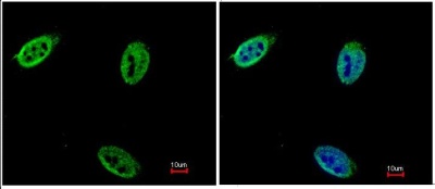 ab95956, at a 1/200 dilution, staining Nucleoporin p62 in paraformaldehyde fixed HeLa by Immunofluorescence. Image on the right: merged with DNA probe.