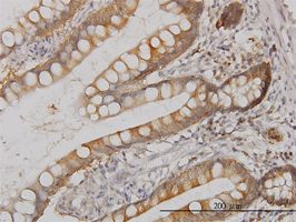 SAPK4 antibody (ab57719) used in immunohistochemistry at 1ug/ml on formalin fixed and paraffin embedded human small Intestine.