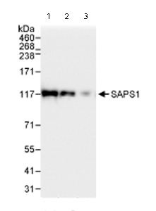 All lanes : Anti-SAPS1 antibody (ab72030) at 0.04 µg/mlLane 1 : Whole cell lysate from Hela cells at 50 µgLane 2 : Whole cell lysate from Hela cells at 15 µgLane 3 : Whole cell lysate from Hela cells at 5 µg