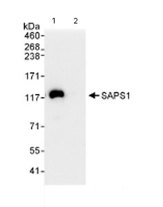 Immunoprecipitation/ Western Blot of SAPS1. Lane 1: ab72030 at 3µg/mg whole cell lysate. Lane 2: Control IgG. Whole cell lysate from Hela cells at 1mg for IP, 20% of IP loaded. ab72030 at 0.1 µg/ml was used for the western blot detection step. Chemiluminescence with an exposure time of 3 seconds.
