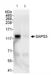 Immunoprecipitation/ Western Blot of SAPS3. Lane 1: For IP: ab72034 at 3µg/mg whole cell lysate, with ab72034 at 0.04µg/ml for subsequent WB. Lane 2: Control IgG. Whole cell lysate from Hela cells at 1mg for IP, 20% of IP loaded. Chemiluminescence with an exposure time of 3 seconds.
