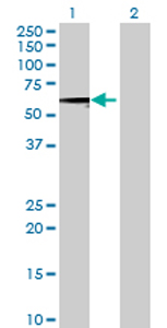 All lanes : Anti-SARS2 antibody (ab69316) at 1/500 dilutionLane 1 : SARS2 transfected 293T cell lysateLane 2 : Non-transfected 293T cell lysateLysates/proteins at 25 µg per lane.SecondaryGoat Anti-Mouse IgG (H&L)-HRP Conjugate at 1/2500 dilution