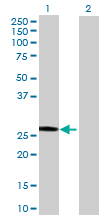 All lanes : Anti-SART3 antibody (ab169302) at 1/500 dilutionLane 1 : SART3-transfected 293T cell lysateLane 2 : Non-transfected 293T cell lysateLysates/proteins at 15 µl per lane.SecondaryGoat Anti-Mouse IgG (H&L)-HRP at 1/2500 dilutiondeveloped using the ECL technique