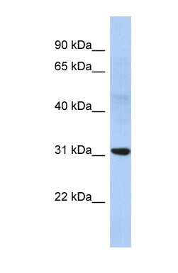 Anti-Nucleoside phosphorylase antibody (ab87789) at 1 µg/ml (in 5% skim milk / PBS buffer) + THP-1 cell lysate at 10 µgSecondaryHRP conjugated anti-Rabbit IgG at 1/50000 dilution
