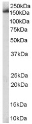 Anti-SART3 antibody (ab36137) at 1 µg/ml + Daudi lysate (RIPA buffer, 30µg total protein per lane).